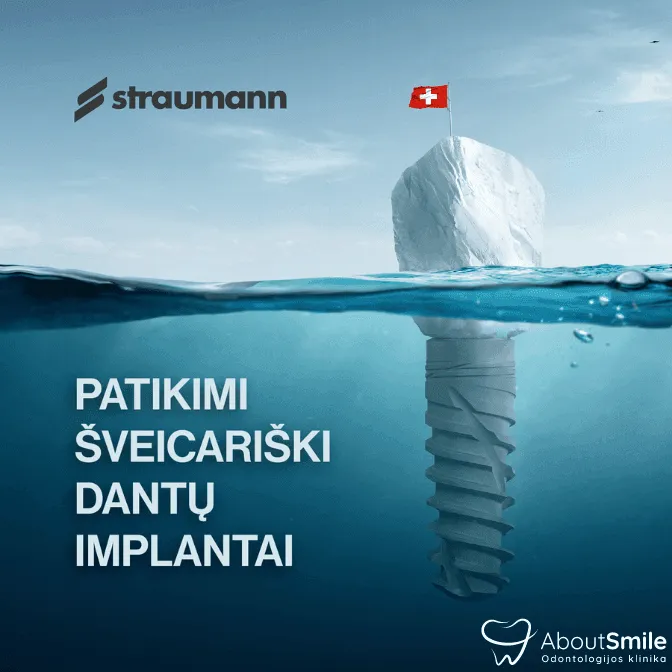 Straumann implantai