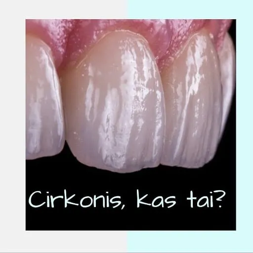 Kas yra cirkonis