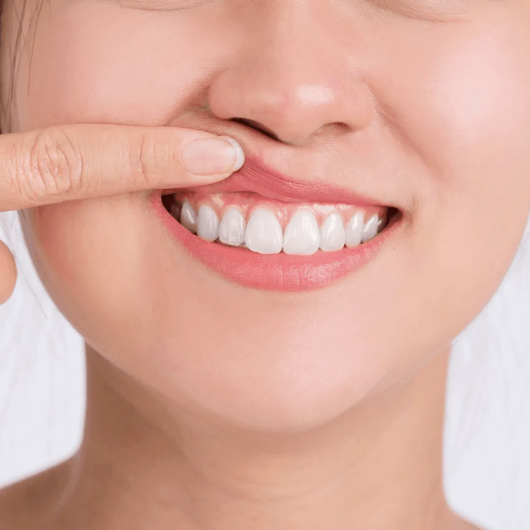 periodontologas